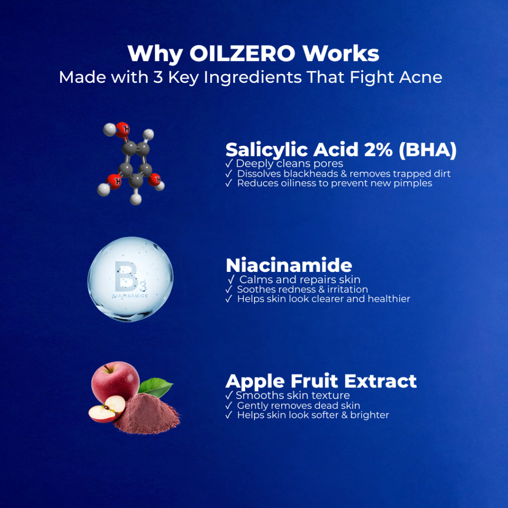 NavyX OilZero Acne Cleanser 80ml