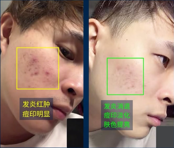 Customer-supplied before and after record 02