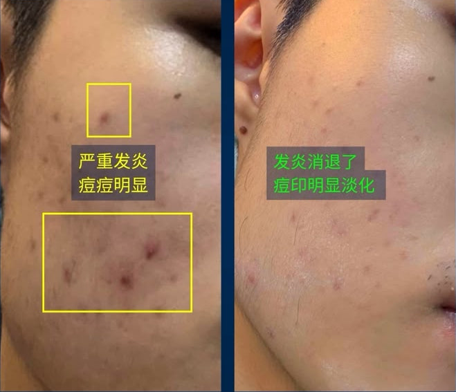 Customer-supplied before and after record 07